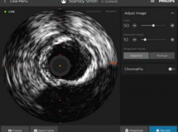 Intrasight Volcano